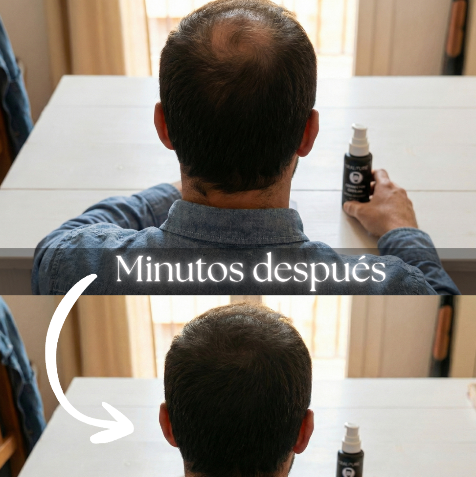 SKALPURE® – Corrector Capilar Profesional