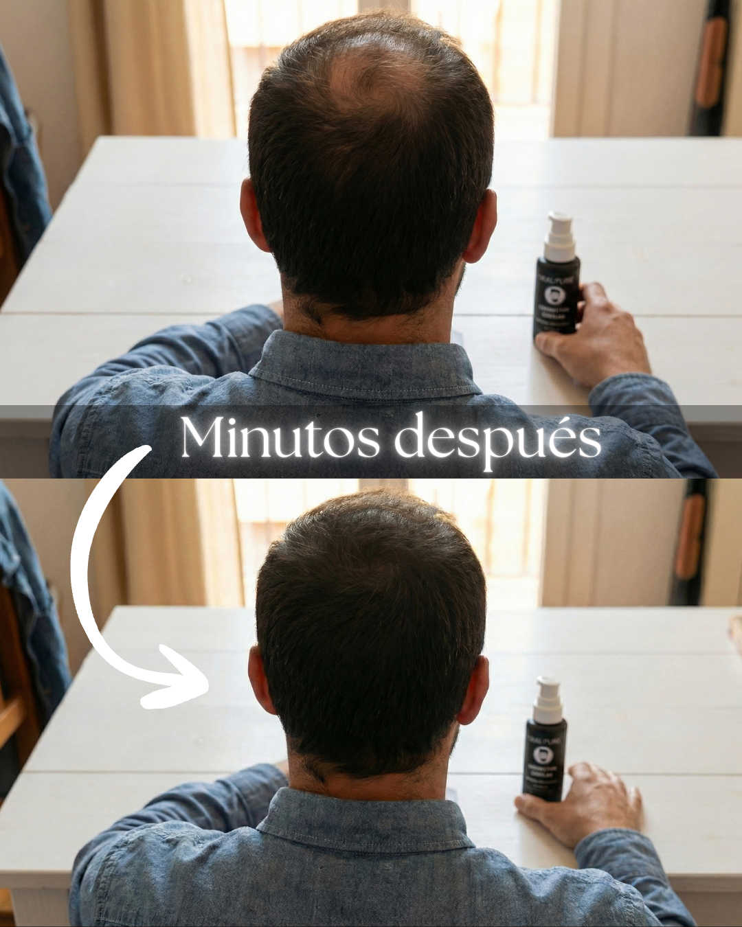 SKALPURE® – Corrector Capilar Profesional